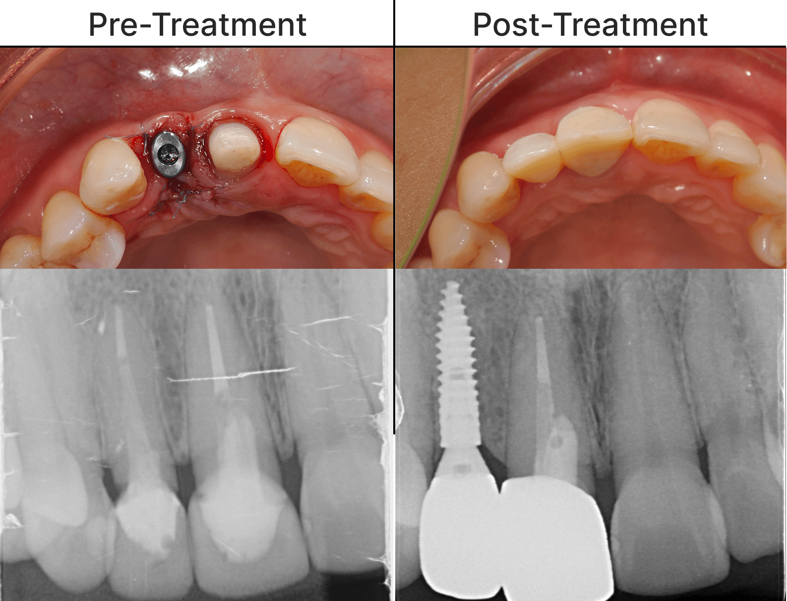 Placeholder after-treatment image for a cosmetic dentistry case