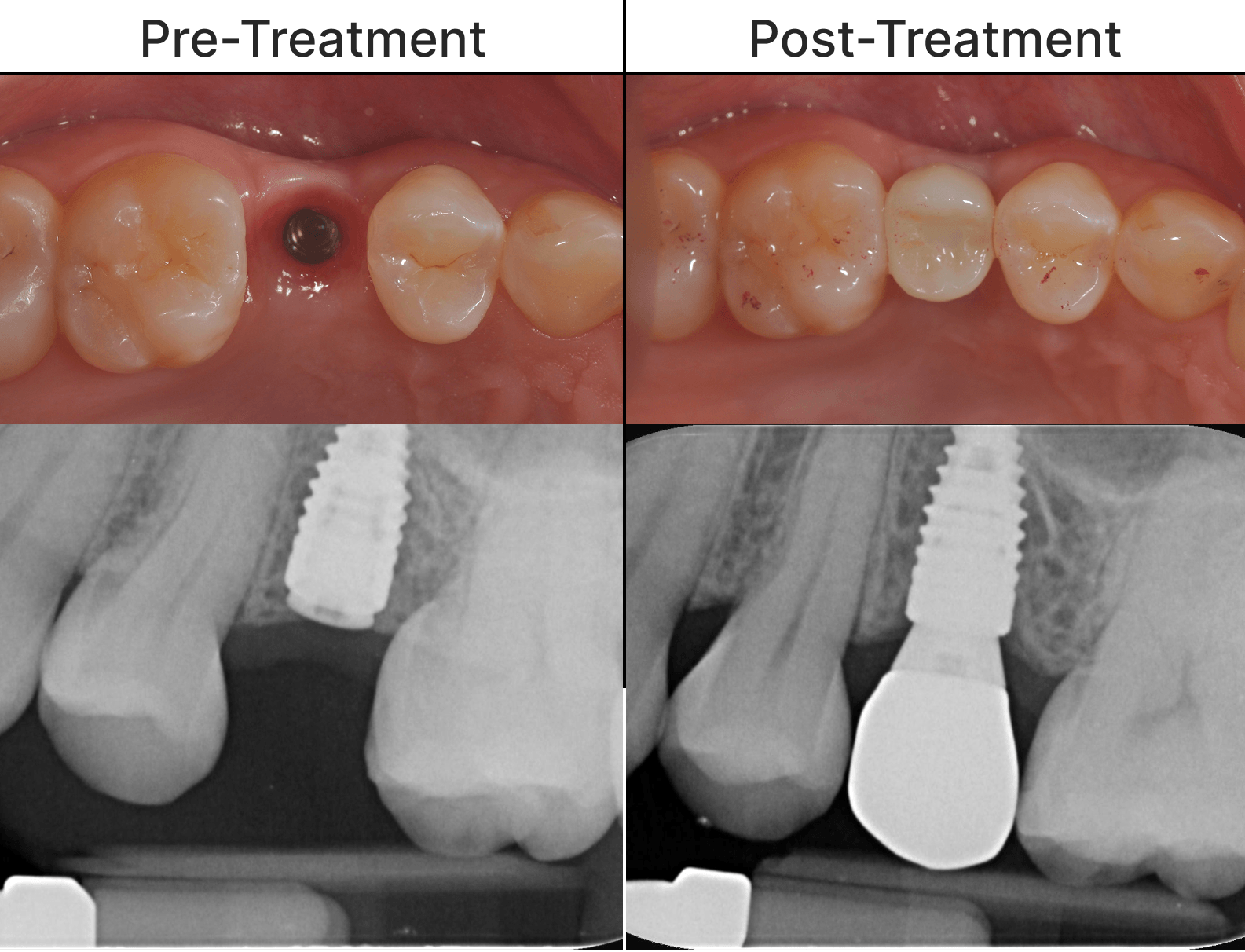 Placeholder after-treatment image for a cosmetic dentistry case