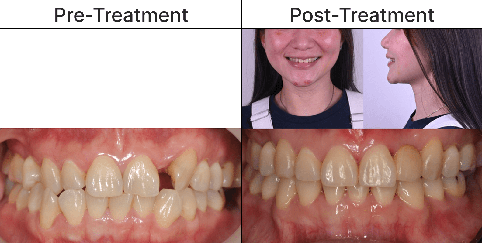 Placeholder after-treatment image for a cosmetic dentistry case