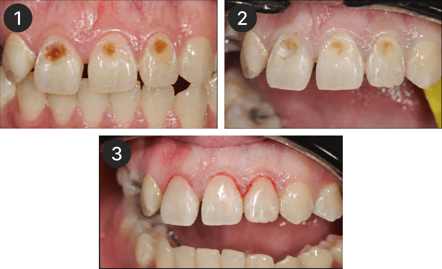Placeholder after-treatment image for a restoration case